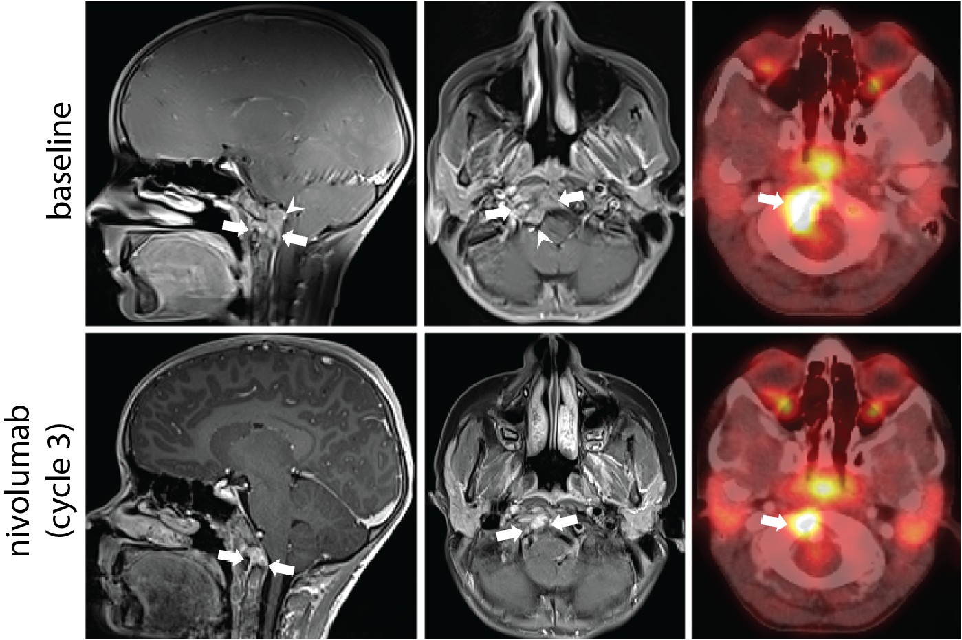 PET/CT images from patient A